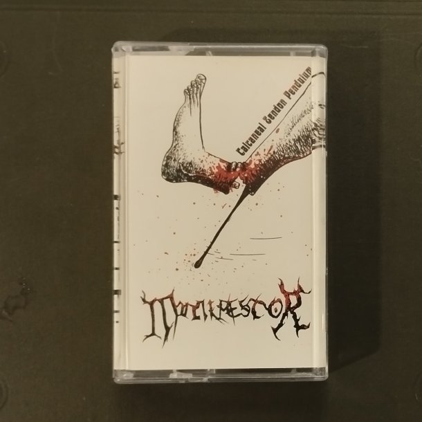 Manifestor &lrm;- Calcaneal Tendon Pendulum MC