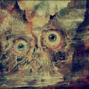 Teratoma - Purulent Manifestations 12